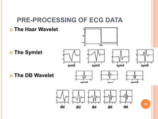 PRE-PROCESSING OF ECG DATA
 The Haar Wavelet
 The Symlet
 The DB Wavelet
20
 