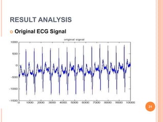 RESULT ANALYSIS
 Original ECG Signal
31
 