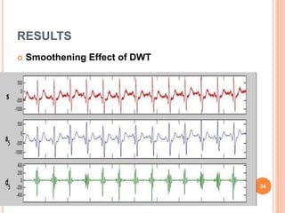 RESULTS
 Smoothening Effect of DWT
34
 