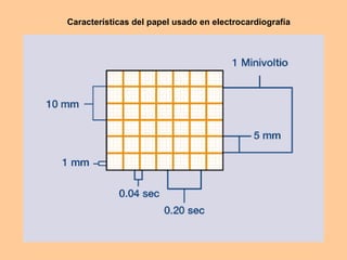 Características del papel usado en electrocardiografía 