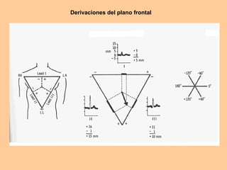Derivaciones del plano frontal 