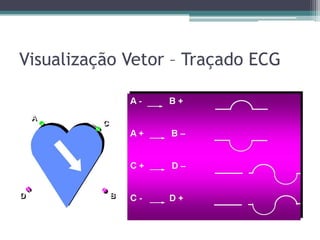 Visualização Vetor – Traçado ECG
 