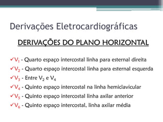 Derivações Eletrocardiográficas
   DERIVAÇÕES DO PLANO HORIZONTAL

V1 - Quarto espaço intercostal linha para esternal direita
V2 - Quarto espaço intercostal linha para esternal esquerda
V3 - Entre V2 e V4
V4 - Quinto espaço intercostal na linha hemiclavicular
V5 - Quinto espaço intercostal linha axilar anterior
V6 - Quinto espaço intercostal, linha axilar média
 