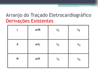 Arranjo do Traçado Eletrocardiográfico
Derivações Existentes
 
