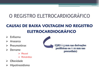 O REGISTRO ELETROCARDIOGRÁFICO
CAUSAS DE BAIXA VOLTAGEM NO REGISTRO
         ELETROCARDIOGRÁFICO
 Enfisema
 Anasarca
 Pneumotórax           (QRS  5 mm nas derivações
                         periféricas ou  10 mm nas
 Derrame                        precordiais)
         Pleural
         Pericárdico
 Obesidade
 Hipotireoidismo
 