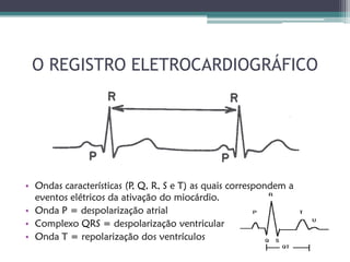 O REGISTRO ELETROCARDIOGRÁFICO




• Ondas características (P Q, R, S e T) as quais correspondem a
                          ,
  eventos elétricos da ativação do miocárdio.
• Onda P = despolarização atrial
• Complexo QRS = despolarização ventricular
• Onda T = repolarização dos ventrículos
 