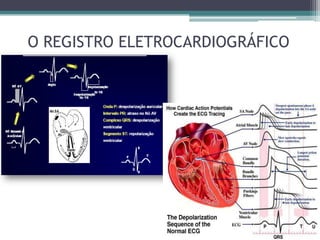 O REGISTRO ELETROCARDIOGRÁFICO
 