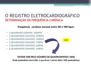 O REGISTRO ELETROCARDIOGRÁFICO
DETERMINAÇÃO DA FREQUÊNCIA CARDÍACA

           Freqüência cardíaca normal entre 60 e 100 bpm.

•   1 QUADRADO GRANDE, 300BPM
•   2 QUADRADOS GRANDES, 150BPM
•   3 QUADRADOS GRANDES, 100BPM                                 OU
•   4 QUADRADOS GRANDES, 75BPM
•   5 QUADRADOS GRANDES, 60BPM
•   6 QUADRADOS GRANDES, 50BPM.


           DIVIDIR 1500 PELO NÚMERO DE QUADRADINHOS ( MM)
      (Cada quadradinho dura 0,04s, o que dá em 1 minuto (60s) 1.500 quadradinhos)
 
