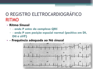 O REGISTRO ELETROCARDIOGRÁFICO
RITMO
• Ritmo Sinusal
  ▫ – onda P antes do complexo QRS
  ▫ – onda P com posição espacial normal (positiva em DI,
    DII e aVF)
• – Frequência adequada ao Nó sinusal
 