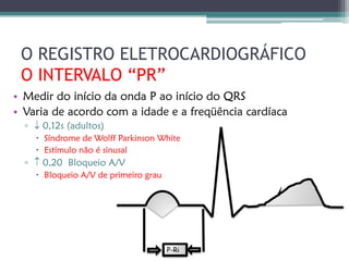 O REGISTRO ELETROCARDIOGRÁFICO
 O INTERVALO “PR”
• Medir do início da onda P ao início do QRS
• Varia de acordo com a idade e a freqüência cardíaca
  ▫  0,12s (adultos)
     Síndrome de Wolff Parkinson White
     Estímulo não é sinusal
  ▫  0,20 Bloqueio A/V
     Bloqueio A/V de primeiro grau




                                      P-Ri
 