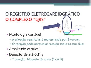 O REGISTRO ELETROCARDIOGRÁFICO
O COMPLEXO “QRS”


• Morfologia variável
 ▫ A ativação ventricular é representada por 3 vetores
 ▫ O coração pode apresentar rotação sobre os seus eixos
• Amplitude variável
• Duração de até 0,11 s
 ▫  duração: bloqueio de ramo (E ou D)
 