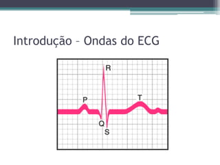 Introdução – Ondas do ECG
 