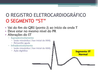 O REGISTRO ELETROCARDIOGRÁFICO
O SEGMENTO “ST”
• Vai do fim do QRS (ponto J) ao início da onda T
• Deve estar no mesmo nível do PR
• Alterações do ST
  ▫ Supradesnivelamento
     Lesão miocárdica ( fase inicial do IAM)
     Pericardite aguda
  ▫ Infradesnivelamento
     Lesão miocárdica ( fase inicial do IAM)
     Ação digitálica                           Segmento ST
                                                  Normal
 