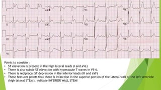 ECG by Adil.pptx