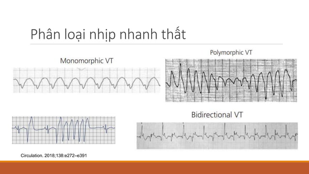ECG Cap cuu (1).pptx
