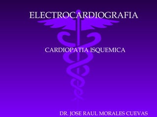ELECTROCARDIOGRAFIA
CARDIOPATIA ISQUEMICA
DR. JOSE RAUL MORALES CUEVAS
 