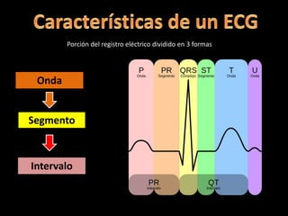 Porción del registro eléctrico dividido en 3 formas
Onda
Segmento
Intervalo
 