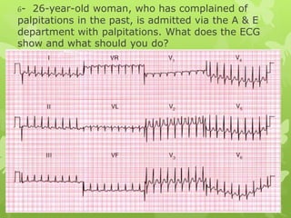 6- 26-year-old woman, who has complained of
palpitations in the past, is admitted via the A & E
department with palpitations. What does the ECG
show and what should you do?
 