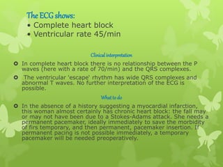 The ECG shows:
• Complete heart block
• Ventricular rate 45/min
Clinicalinterpretation
 In complete heart block there is no relationship between the P
waves (here with a rate of 70/min) and the QRS complexes.
 The ventricular 'escape‘ rhythm has wide QRS complexes and
abnormal T waves. No further interpretation of the ECG is
possible.
Whatto do
 In the absence of a history suggesting a myocardial infarction,
this woman almost certainly has chronic heart block: the fall may
or may not have been due to a Stokes-Adams attack. She needs a
permanent pacemaker, ideally immediately to save the morbidity
of firs temporary, and then permanent, pacemaker insertion. If
permanent pacing is not possible immediately, a temporary
pacemaker will be needed preoperatively.
 