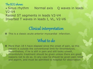 The ECGshows:
• Sinus rhythm Normal axis Q waves in leads
V2-V4
Raised ST segments in leads V2-V4
Inverted T waves in leads I, VL, V2-V6
Clinical interpretation
 This is a classic acute anterior myocardial infarction.
What to do
 More than 18 h have elapsed since the onset of pain, so this
patient is outside the conventional limit for thrombolysis.
Nevertheless, if he is still in pain and still looks unwell,
thrombolytic treatment should be given unless there are good
reasons not to do so. In any case he should be given pain relief
and aspirin, and must be admitted to hospital for observation.
 