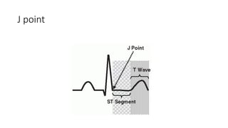 Electrocardiogram case questions and answers.pptx