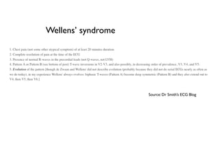 Wellens’ syndrome
Source: Dr Smith’s ECG Blog
