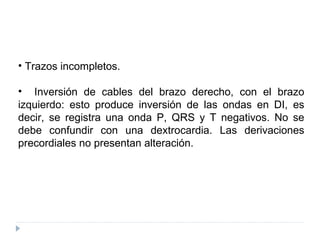 Trazos incompletos. Inversión de cables del brazo derecho, con el brazo izquierdo: esto produce inversión de las ondas en DI, es decir, se registra una onda P, QRS y T negativos. No se debe confundir con una dextrocardia. Las derivaciones precordiales no presentan alteración. 