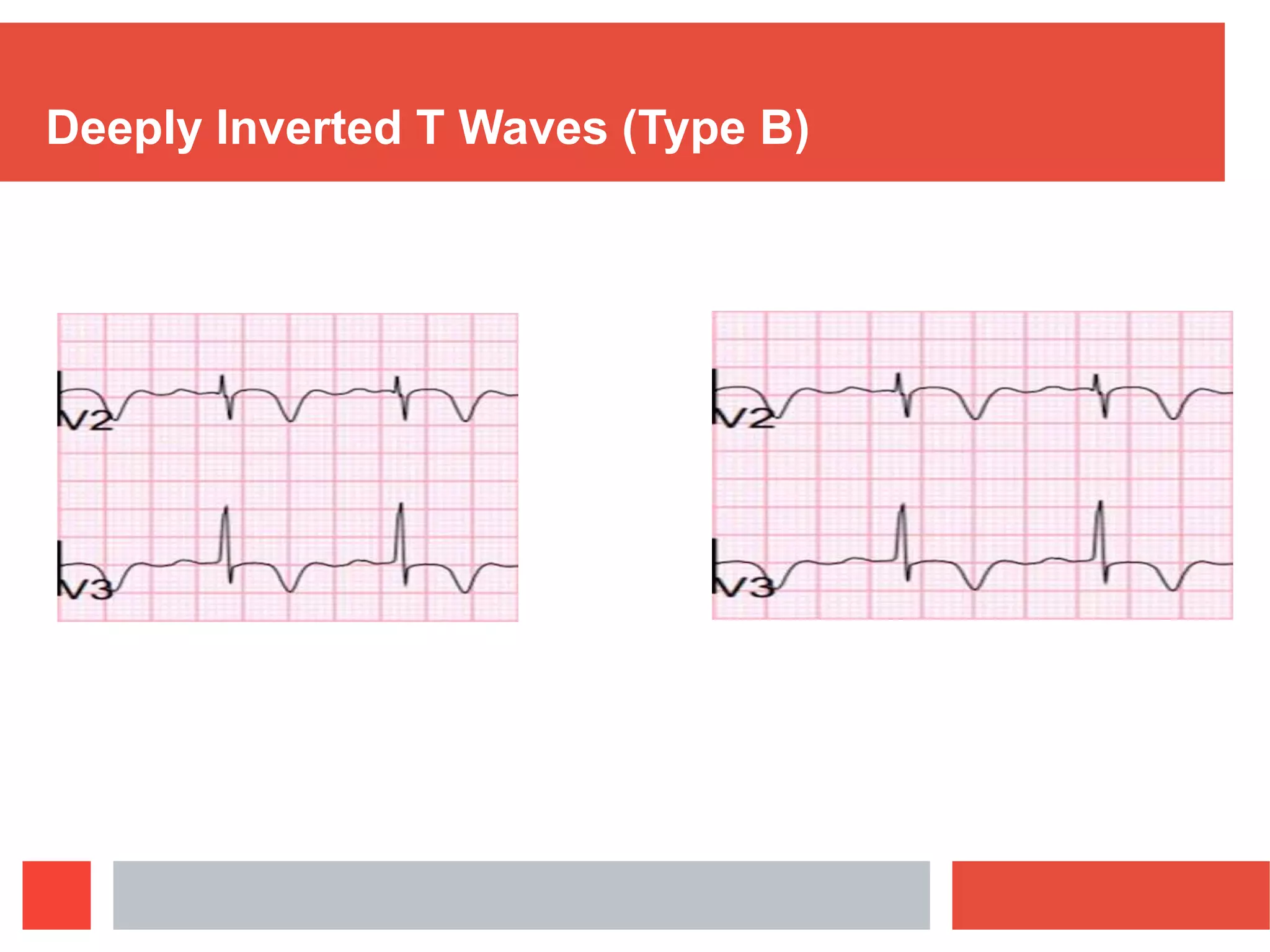 心电描记术[编辑] visual data 7