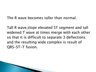 The R wave becomes taller than normal.
Tall R wave,slope elevated ST segment and tall
widened T wave at times merge with each other
so that it is difficult to separate 3 deflections
and the resulting wide complex is result of
QRS-ST-T fusion.
 