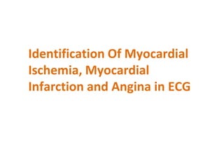 Identification Of Myocardial
Ischemia, Myocardial
Infarction and Angina in ECG
 