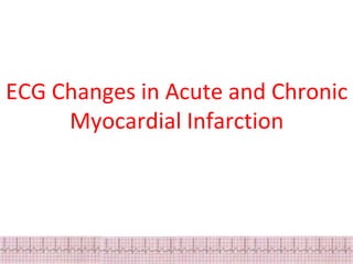 ECG Changes in Myocardial ischemia, myocardial infarction.pptx