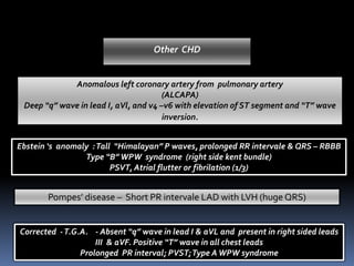 Ebstein ‘s anomaly :Tall “Himalayan” P waves, prolonged RR intervale & QRS – RBBB
Type “B”WPW syndrome (right side kent bundle)
PSVT, Atrial flutter or fibrilation (1/3)
Anomalous left coronary artery from pulmonary artery
(ALCAPA)
Deep “q” wave in lead I, aVl, and v4 –v6 with elevation of ST segment and “T” wave
inversion.
Pompes’ disease – Short PR intervale LAD with LVH (huge QRS)
Other CHD
Corrected -T.G.A. - Absent “q” wave in lead I & aVL and present in right sided leads
III & aVF. Positive “T” wave in all chest leads
Prolonged PR interval; PVST;Type AWPW syndrome
 