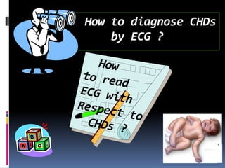 How to diagnose CHDs
by ECG ?
 
