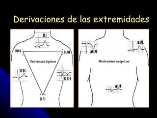 Derivaciones de las extremidades
 
