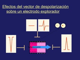 Efectos del vector de despolarización
  sobre un electrodo explorador


                                -   +




              Despolarizaciòn
 