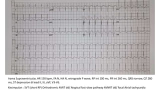 ecg club.pptx