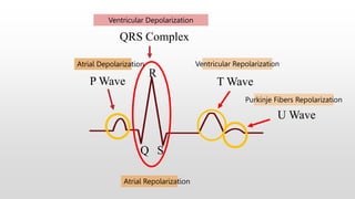 Q S
R
QRS Complex
P Wave T Wave
Ventricular Repolarization
Ventricular Depolarization
Atrial Depolarization
Atrial Repolarization
U Wave
Purkinje Fibers Repolarization
 