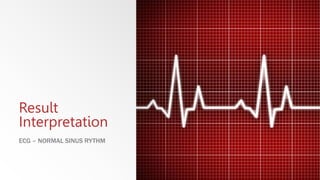 Result
Interpretation
ECG – NORMAL SINUS RYTHM
 
