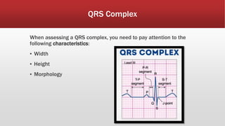 QRS Complex
When assessing a QRS complex, you need to pay attention to the
following characteristics:
▪ Width
▪ Height
▪ Morphology
 