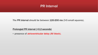 PR Interval
The PR interval should be between 120-200 ms (3-5 small squares).
Prolonged PR interval (>0.2 seconds)
▪ presence of atrioventricular delay (AV block).
 