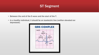 ST Segment
▪ Between the end of the S wave and the start of the T.
▪ In a healthy individual, it should be an isoelectric line (neither elevated nor
depressed).
 