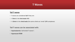 T Waves
Tall T waves
▪ T waves are considered tall if they are:
▪ > 5mm in the limb leads AND
▪ > 10mm in the chest leads (the same criteria as ‘small’ QRS complexes)
Tall T waves can be associated with:
▪ Hyperkalaemia (“tall tented T waves”)
▪ Hyperacute STEMI
 
