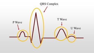 P Wave
QRS Complex
T Wave
U Wave
 