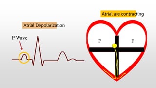 P Wave
Atrial Depolarization
P P
Atrial are contracting
 
