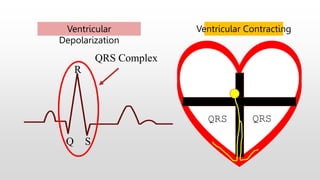 Q S
R
Ventricular
Depolarization
QRS
Ventricular Contracting
QRS
QRS Complex
 