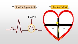 T Wave
T
Ventricular Relaxing
T
Ventricular Repolarization
 