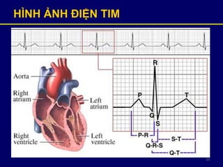 10
HÌNH ẢNH ĐIỆN TIM
 