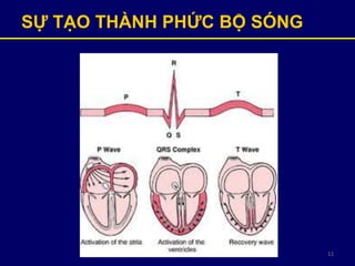 11
SỰ TẠO THÀNH PHỨC BỘ SÓNG
 