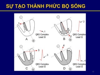 12
SỰ TẠO THÀNH PHỨC BỘ SÓNG
 