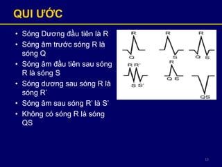 13
QUI ƢỚC
• Sóng Dương đầu tiên là R
• Sóng âm trước sóng R là
sóng Q
• Sóng âm đầu tiên sau sóng
R là sóng S
• Sóng dương sau sóng R là
sóng R’
• Sóng âm sau sóng R’ là S’
• Không có sóng R là sóng
QS
 